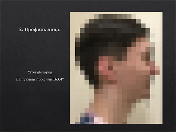 prezent_5